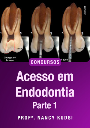 Cover for Acesso em Endodontia Para Concursos - Parte I
