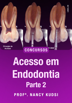 Cover for Acesso em Endodontia Para Concursos - Parte II