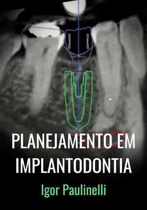 Cover for Planejamento em Implantodontia