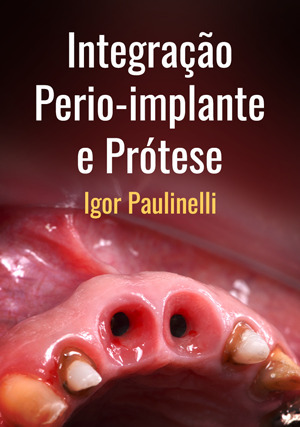 Cover for Integração Perio-implante e Prótese