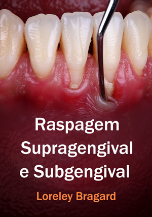 Cover for Raspagem Supragengival e Subgengival