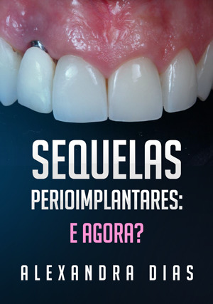 Cover for Sequelas Perioimplantares: E agora?