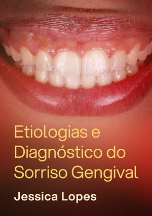 Cover for Etiologias e Diagnóstico do Sorriso Gengival