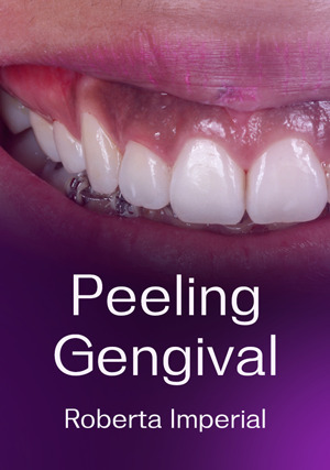 Cover for Peeling Gengival