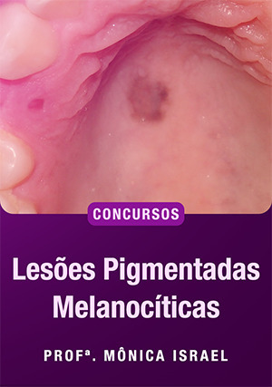 Cover for Lesões Pigmentadas Melanocíticas para Concursos