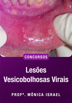Cover for Lesões Vesicobolhosas Virais para Concursos