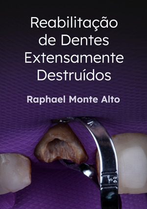 Cover for Reabilitação de Dentes Extensamente Destruídos