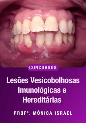 Cover for Lesões Vesicobolhosas Imunológicas e Hereditárias para Concursos