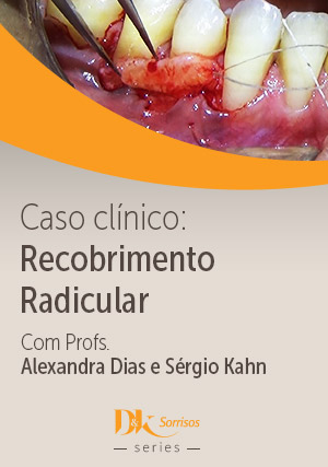 Cover for Caso Clínico: Recobrimento Radicular