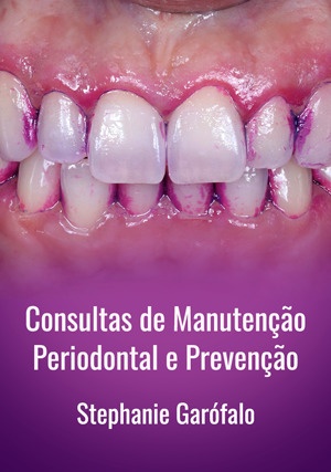 Cover for Consultas de Manutenção Periodontal e Prevenção