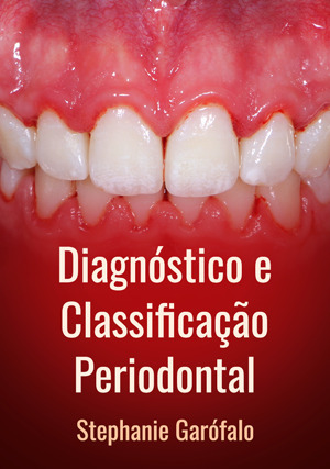 Cover for Diagnóstico e Classificação Periodontal