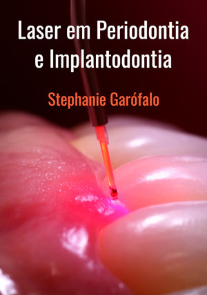 Cover for Laser em Periodontia e Implantodontia