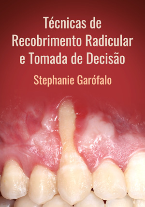 Cover for Técnicas de Recobrimento Radicular e Tomada de Decisão