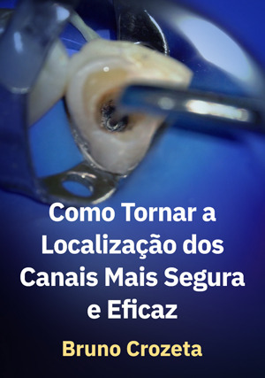 Cover for Como Tornar a Localização dos Canais mais Segura e Eficaz