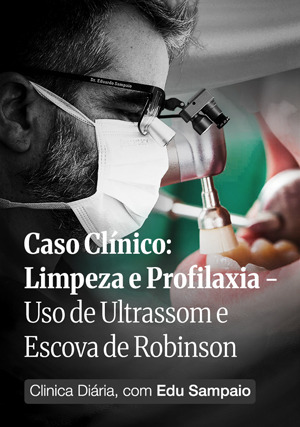 Cover for Caso Clínico: Limpeza e Profilaxia: Uso de Ultrassom e Escova de Robinson