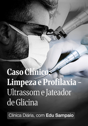 Cover for Caso Clínico: Limpeza e Profilaxia: Ultrassom e Jateador de Glicina