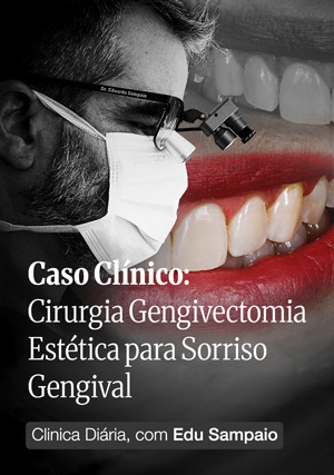 Cover for Caso Clínico: Cirurgia Gengivectomia Estética para Sorriso Gengival