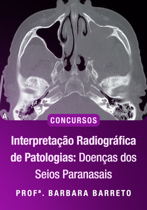 Cover for Interpretação Radiográfica de Patologias: Doenças dos seios Paranasais para concursos