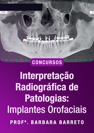 Cover for Interpretação Radiográfica de Patologias: Implantes Orofaciais para concursos