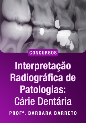 Cover for Interpretação Radiográfica de Patologias: Cárie Dentária para concursos