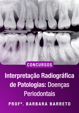 Cover for Interpretação Radiográfica de Patologias: Doenças Periodontais para concursos