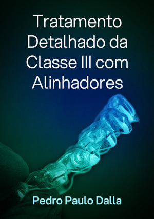 Cover for Tratamento Detalhado da Classe III com Alinhadores