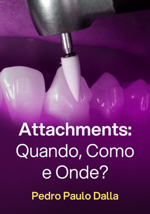 Cover for Attachments: quando, como e onde?