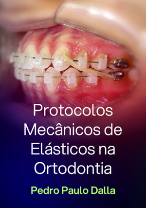 Cover for Protocolos Mecânicos de Elásticos na Ortodontia