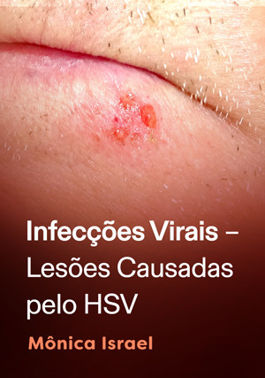 Cover for Infecções virais – lesões causadas pelo HSV