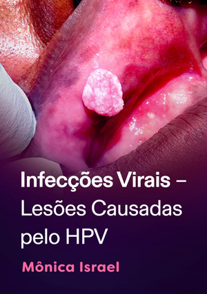 Cover for Infecções virais – lesões Causadas pelo HPV