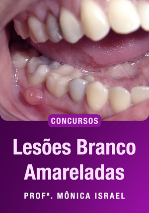 Cover for Lesões Branco Amareladas para Concursos