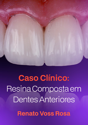 Cover for Caso Clínico: Resina Composta em Dentes Anteriores