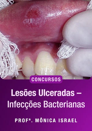 Cover for Infecções Bacterianas para Concursos