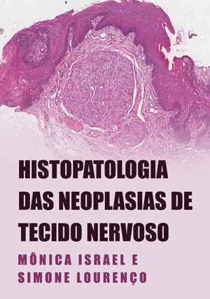 Cover for Histopatologia das Neoplasias de Tecido Nervoso