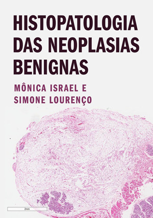 Cover for Histopatologia das Neoplasias Benignas