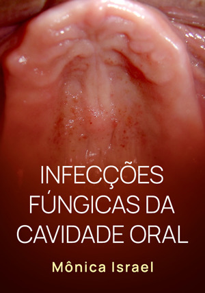 Cover for Infecções Fúngicas da Cavidade Oral