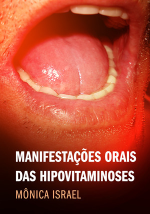 Cover for Manifestações Orais das Hipovitaminoses