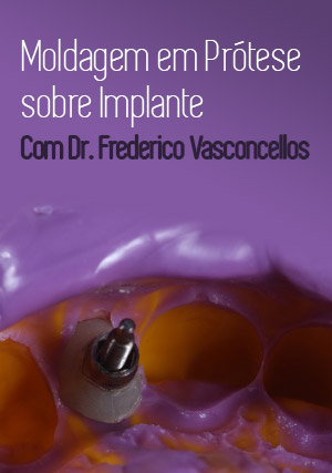 Cover for Moldagem em Prótese sobre Implantes