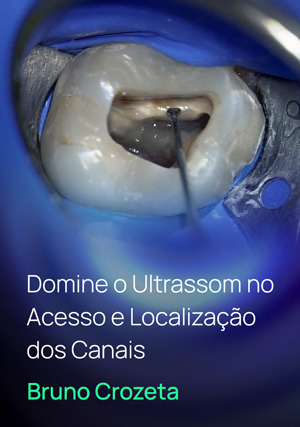Cover for Domine o Ultrassom no Acesso e Localização dos Canais