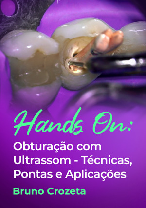 Cover for Hands on: Obturação com Ultrassom - Técnicas, Pontas e Aplicações