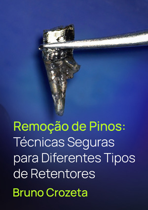 Cover for Remoção de Pinos: Técnicas Seguras para Diferentes Tipos de Retentores
