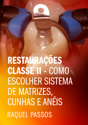 Cover for Restaurações Classe II - Como Escolher Sistema de Matrizes, Cunhas e Anéis