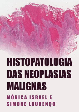 Cover for Histopatologia das Neoplasias Malignas