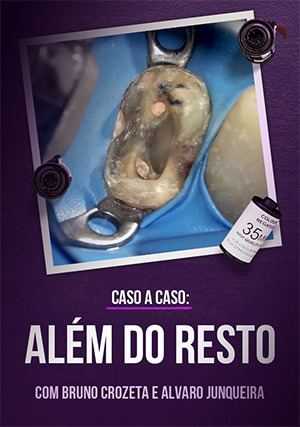 Cover for Caso a Caso - Além do Resto