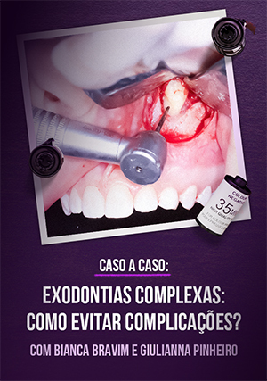 Cover for Ao Vivo - Caso a Caso - Exodontias Complexas: como evitar complicações?