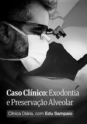 Cover for Caso Clínico: Exodontia e Preservação Alveolar
