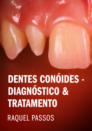 Cover for Dentes Conóides - Diagnóstico & Tratamento