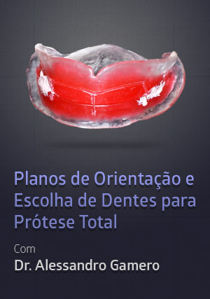 Cover for Planos de Orientação e Escolha de Dentes para Prótese Total
