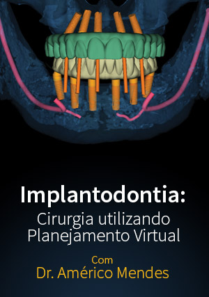 Cover for Implantodontia: Cirurgia com Planejamento Virtual