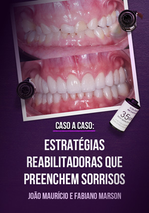Cover for Caso a Caso - Estratégias Reabilitadoras que Preenchem Sorrisos